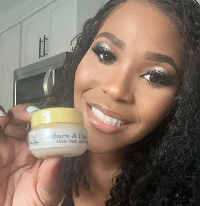 Sunburn Under Eye Lotion The TJCollectibles